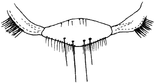 Ornithoctona laticornis, scutellum.