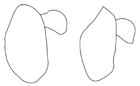 Chamaepsila hebraica, genitalia in lateral view